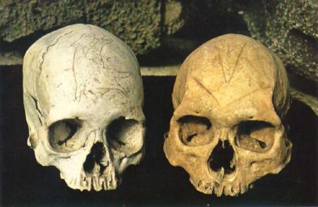 skull